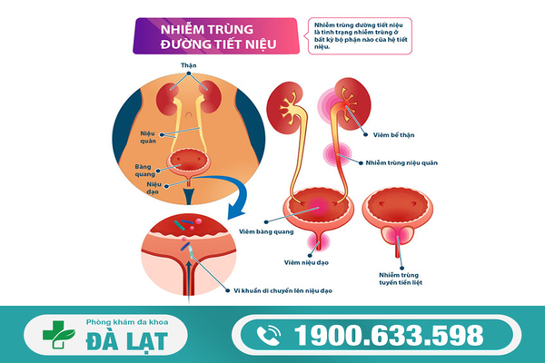 Hình ảnh minh họa